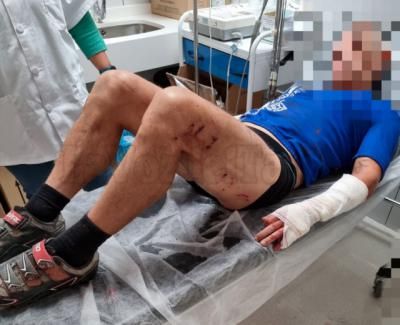 Brutal ataque de tres perros a un ciclista, impresionantes imágenes