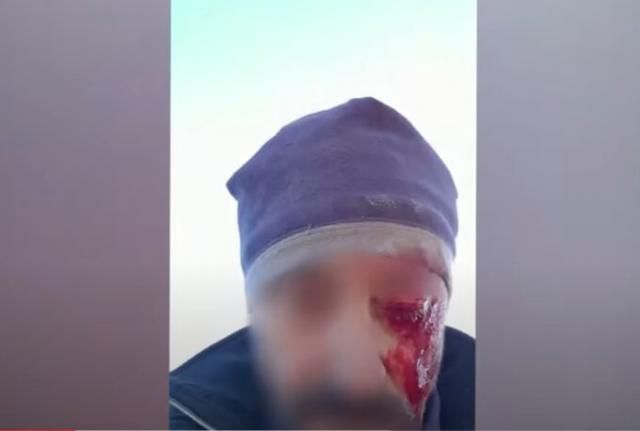 El cazador toledano que agredió brutalmente a un vecino, repudiado por su compañeros (Imágenes duras)